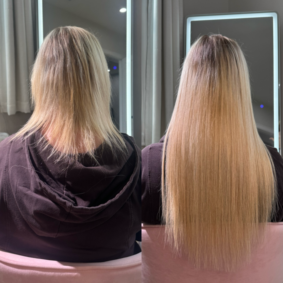 Extreme volume filler
